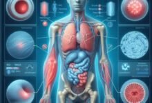 guideline update for soft tissue disorder ultrasound rheum